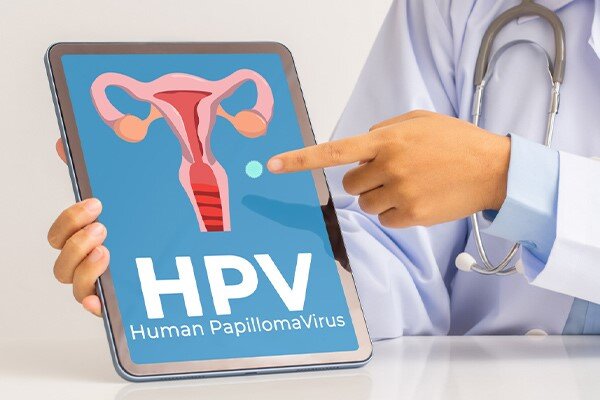چالش‌های دسترسی به واکسن HPV در ایران؛ از تحریم تا بازار سیاه/ عرضه واکسن‌های تقلبی با لیبل‌های جعلی وزارت بهداشت